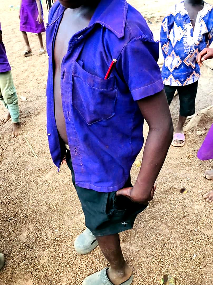 Child showing need for school uniform support in Ghana